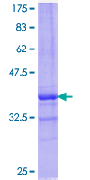 ALOX15B / 15-LOX-2 Protein - 12.5% SDS-PAGE Stained with Coomassie Blue.