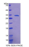 ALOX15B / 15-LOX-2 Protein - Recombinant Arachidonate-15-Lipoxygenase, Type B By SDS-PAGE