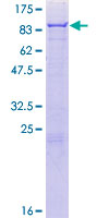 ALOX5 / 5-LOX Protein - 12.5% SDS-PAGE of human ALOX5 stained with Coomassie Blue