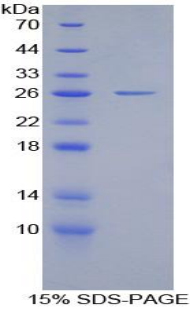 ALOX5 / 5-LOX Protein - Recombinant Arachidonate-5-Lipoxygenase By SDS-PAGE