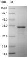 ALOX5AP / FLAP Protein - (Tris-Glycine gel) Discontinuous SDS-PAGE (reduced) with 5% enrichment gel and 15% separation gel.