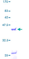 ALOX5AP / FLAP Protein - 12.5% SDS-PAGE of human ALOX5AP stained with Coomassie Blue