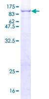 ALOXE3 Protein - 12.5% SDS-PAGE of human ALOXE3 stained with Coomassie Blue