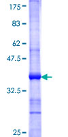 ALOXE3 Protein - 12.5% SDS-PAGE Stained with Coomassie Blue.