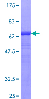 Alpha-1-Antichymotrypsin Protein - 12.5% SDS-PAGE of human SERPINA3 stained with Coomassie Blue