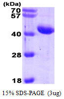 Alpha-1-Antichymotrypsin Protein