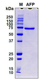 Alpha-Fetoprotein Protein - SDS-PAGE under reducing conditions and visualized by Coomassie blue staining
