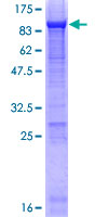 Alpha-Fetoprotein Protein - 12.5% SDS-PAGE of human AFP stained with Coomassie Blue