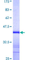 Alpha-Fetoprotein Protein - 12.5% SDS-PAGE Stained with Coomassie Blue.