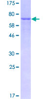 Alpha Fucosidase / FUCA1 Protein - 12.5% SDS-PAGE of human FUCA1 stained with Coomassie Blue