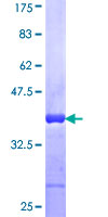 Alpha Fucosidase / FUCA1 Protein - 12.5% SDS-PAGE Stained with Coomassie Blue.