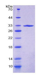 Alpha Fucosidase / FUCA1 Protein - Recombinant Fucosidase Alpha L1, Tissue By SDS-PAGE