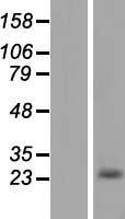 Alpha-S1-Casein / CSN1S1 Protein - Western validation with an anti-DDK antibody * L: Control HEK293 lysate R: Over-expression lysate