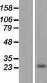 Alpha-S1-Casein / CSN1S1 Protein - Western validation with an anti-DDK antibody * L: Control HEK293 lysate R: Over-expression lysate