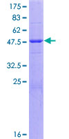 Alpha-S1-Casein / CSN1S1 Protein - 12.5% SDS-PAGE of human CSN1S1 stained with Coomassie Blue