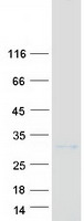 Alpha-S1-Casein / CSN1S1 Protein - Purified recombinant protein CSN1S1 was analyzed by SDS-PAGE gel and Coomassie Blue Staining