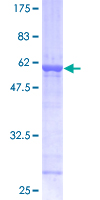 Alpha SNAP Protein - 12.5% SDS-PAGE of human NAPA stained with Coomassie Blue