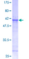 Alpha SNAP Protein - 12.5% SDS-PAGE of human NAPA stained with Coomassie Blue
