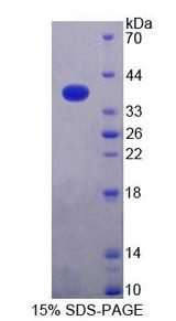 Alpha SNAP Protein - Recombinant N-Ethylmaleimide Sensitive Factor Attachment Protein Alpha By SDS-PAGE