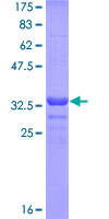 ALPI / Alkaline Phosphatase Protein - 12.5% SDS-PAGE Stained with Coomassie Blue.