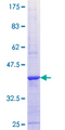 ALPK1 Protein - 12.5% SDS-PAGE Stained with Coomassie Blue.