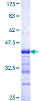 ALPK3 Protein - 12.5% SDS-PAGE Stained with Coomassie Blue.