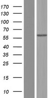 ALPL / Alkaline Phosphatase Protein - Western validation with an anti-DDK antibody * L: Control HEK293 lysate R: Over-expression lysate