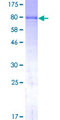 ALPL / Alkaline Phosphatase Protein - 12.5% SDS-PAGE of human ALPL stained with Coomassie Blue