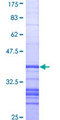 ALPL / Alkaline Phosphatase Protein - 12.5% SDS-PAGE Stained with Coomassie Blue.