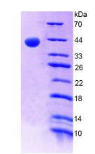ALPL / Alkaline Phosphatase Protein - Recombinant Alkaline Phosphatase, Liver/Bone/Kidney By SDS-PAGE