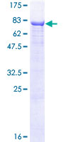 ALPPL2 Protein - 12.5% SDS-PAGE of human ALPPL2 stained with Coomassie Blue