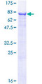 ALPPL2 Protein - 12.5% SDS-PAGE of human ALPPL2 stained with Coomassie Blue