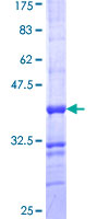 ALPPL2 Protein - 12.5% SDS-PAGE Stained with Coomassie Blue.