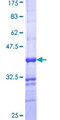 ALPPL2 Protein - 12.5% SDS-PAGE Stained with Coomassie Blue.
