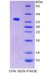 ALPPL2 Protein - Recombinant Alkaline Phosphatase, Placental Like Protein 2 By SDS-PAGE