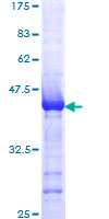 ALS2 / Alsin Protein - 12.5% SDS-PAGE Stained with Coomassie Blue.