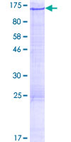 ALS2CL Protein - 12.5% SDS-PAGE of human ALS2CL stained with Coomassie Blue