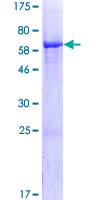 ALS2CR1 / NIF3L1 Protein - 12.5% SDS-PAGE of human NIF3L1 stained with Coomassie Blue
