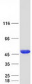 ALS2CR1 / NIF3L1 Protein - Purified recombinant protein NIF3L1 was analyzed by SDS-PAGE gel and Coomassie Blue Staining