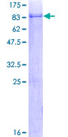 ALS2CR15 / ICA1L Protein - 12.5% SDS-PAGE of human ICA1L stained with Coomassie Blue