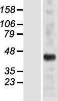 ALX / HSH2D Protein - Western validation with an anti-DDK antibody * L: Control HEK293 lysate R: Over-expression lysate