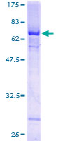ALX / HSH2D Protein - 12.5% SDS-PAGE of human HSH2D stained with Coomassie Blue