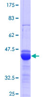 ALX / HSH2D Protein - 12.5% SDS-PAGE Stained with Coomassie Blue.