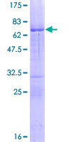 ALX1 Protein - 12.5% SDS-PAGE of human CART1 stained with Coomassie Blue