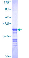 ALX1 Protein - 12.5% SDS-PAGE Stained with Coomassie Blue.