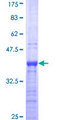 ALX3 Protein - 12.5% SDS-PAGE Stained with Coomassie Blue.