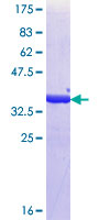 ALY / THOC4 Protein - 12.5% SDS-PAGE Stained with Coomassie Blue.