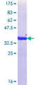 ALY / THOC4 Protein - 12.5% SDS-PAGE Stained with Coomassie Blue.