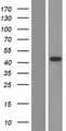 AMACR / P504S Protein - Western validation with an anti-DDK antibody * L: Control HEK293 lysate R: Over-expression lysate
