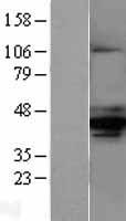 AMACR / P504S Protein - Western validation with an anti-DDK antibody * L: Control HEK293 lysate R: Over-expression lysate